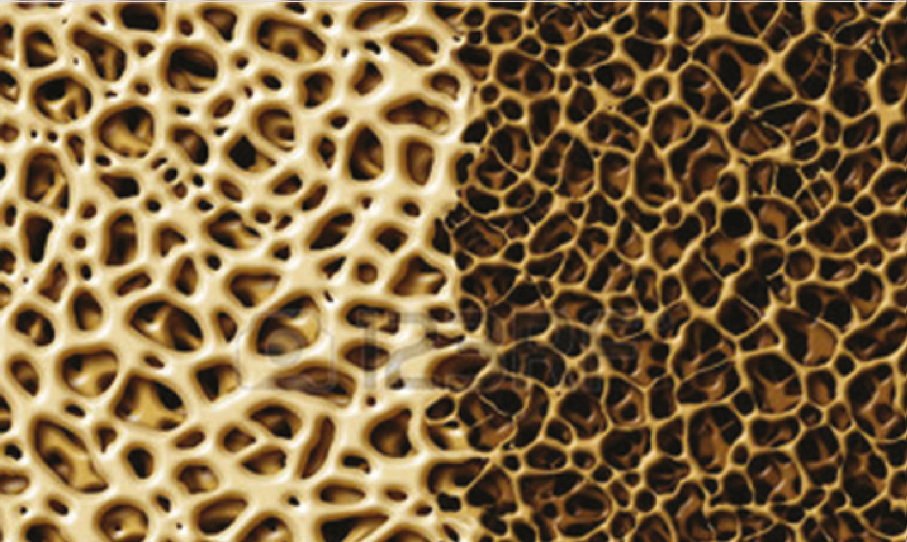 Sicherheit des Knochenmaterials